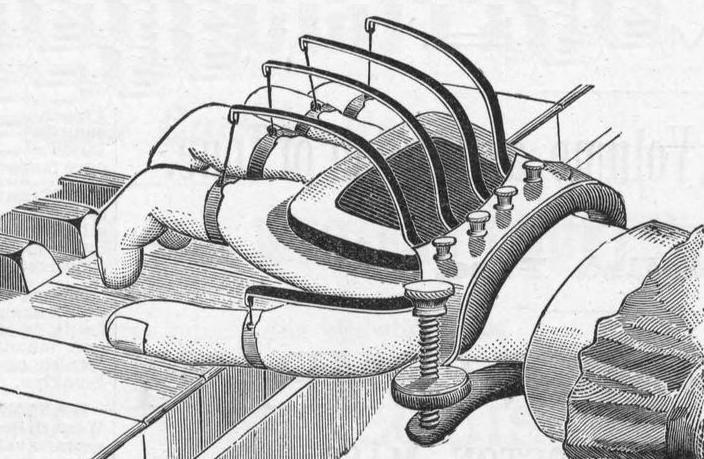 DAMAGING HAND EXERCISE APPARATUS OF THE NINETEENTH CENTURY
